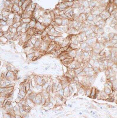 Immunohistochemistry-Paraffin: CD155/PVR Antibody (BLR074G) [NBP2-78711]