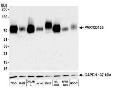 Western Blot: CD155/PVR Antibody (BLR074G) [NBP2-78711]