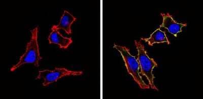 Immunocytochemistry/ Immunofluorescence: CD155/PVR Antibody (D171) [NB600-1241]