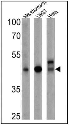 Western Blot: CD155/PVR Antibody (D171) [NB600-1241]