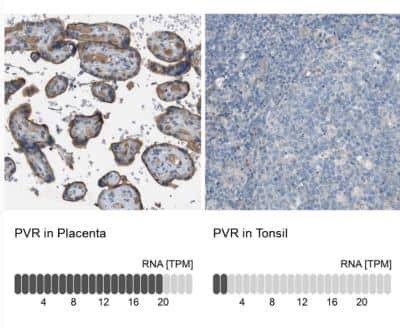 Immunohistochemistry-Paraffin: CD155/PVR Antibody [NBP1-88131]