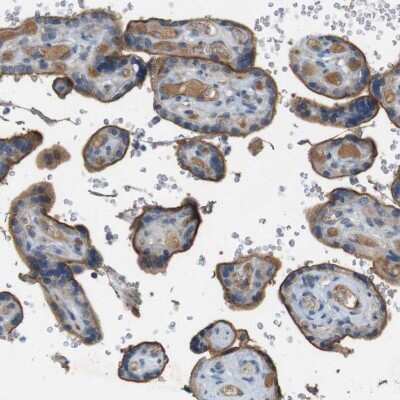 Immunohistochemistry-Paraffin: CD155/PVR Antibody [NBP1-88131]