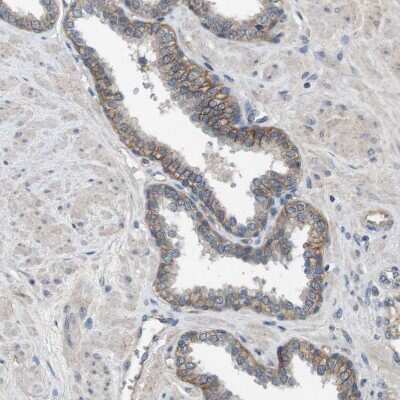 Immunohistochemistry-Paraffin: CD155/PVR Antibody [NBP1-88131]