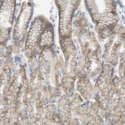 Immunohistochemistry-Paraffin: CD155/PVR Antibody [NBP1-88131]