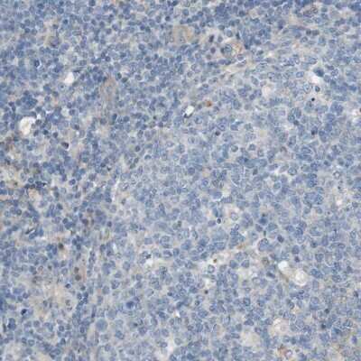 Immunohistochemistry-Paraffin: CD155/PVR Antibody [NBP1-88131]