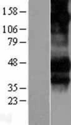 Western Blot: Fc gamma RIIIA/CD16a Overexpression Lysate [NBL1-10658]