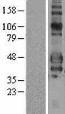 Western Blot: Fc gamma RIIIA/CD16a Overexpression Lysate [NBP2-11370]