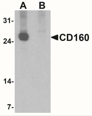 Western Blot: CD160 AntibodyBSA Free [NBP2-41234]