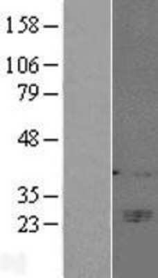 Western Blot: CD160 Overexpression Lysate [NBL1-08908]