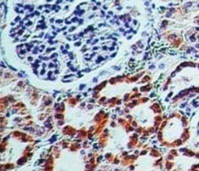 Immunohistochemistry-Paraffin: CD161 Antibody (14F1F11) - Azide and BSA Free [NBP2-31359]
