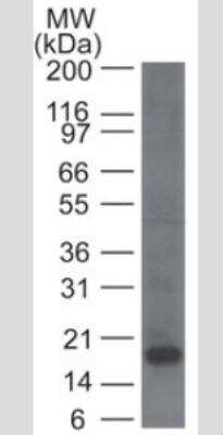 Western Blot: CD161 Antibody (14F1F11)Azide and BSA Free [NBP2-31359]