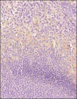Immunohistochemistry-Paraffin: CD161 Antibody (14F1F11) - BSA Free [NBP2-14845]