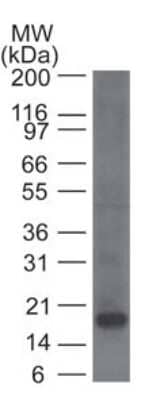 Western Blot: CD161 Antibody (14F1F11)BSA Free [NBP2-14845]