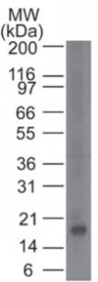 Western Blot: CD161 Antibody (14F2F11) [NBP2-14844]