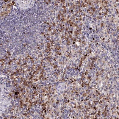 Immunohistochemistry-Paraffin: CD161 Antibody [NBP1-88130]