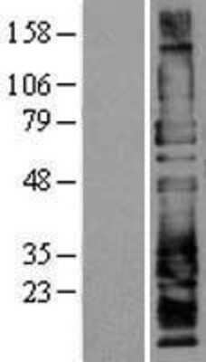 Western Blot: PSGL-1/CD162 Overexpression Lysate [NBP2-10860]