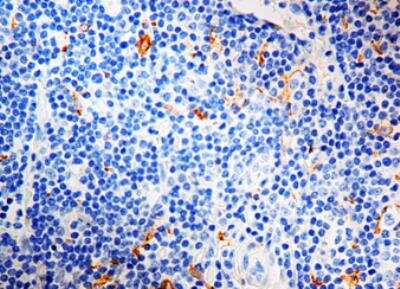 Immunohistochemistry-Paraffin: CD163 Antibody (10D6) [NB110-59935]