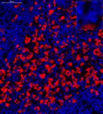 Immunohistochemistry-Paraffin: CD163 Antibody (10D6) [NB110-59935]