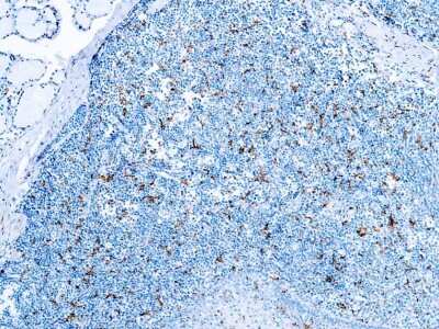 Immunohistochemistry-Paraffin: CD163 Antibody (10D6) [NB110-59935]