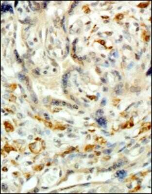 Immunohistochemistry: CD163 Antibody (6D3.2F3) - Azide and BSA Free [NBP2-80632]
