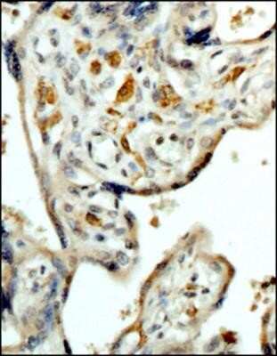 Immunohistochemistry-Paraffin: CD163 Antibody (6D3.2F3) - Azide and BSA Free [NBP2-80632]