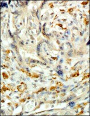 Immunohistochemistry-Paraffin: CD163 Antibody (6D3.2F3) - BSA Free [NBP2-36495]