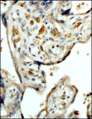Immunohistochemistry-Paraffin: CD163 Antibody (6D3.2F3) - BSA Free [NBP2-36495]