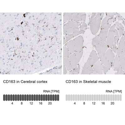 Immunohistochemistry-Paraffin: CD163 Antibody (CL10652) [NBP3-07981]