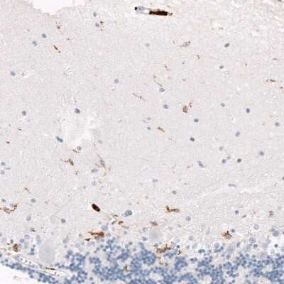 Immunohistochemistry-Paraffin: CD163 Antibody (CL10652) [NBP3-07981]