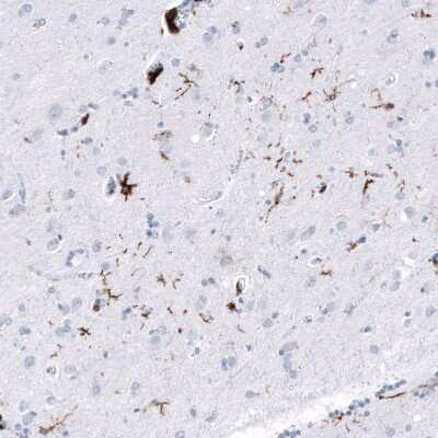 Immunohistochemistry-Paraffin: CD163 Antibody (CL10652) [NBP3-07981]