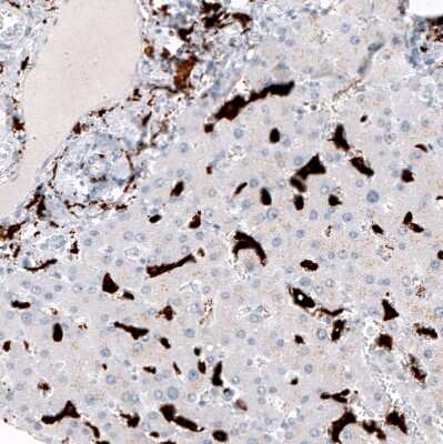 Immunohistochemistry-Paraffin: CD163 Antibody (CL10652) [NBP3-07981]