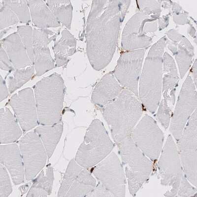 Immunohistochemistry-Paraffin: CD163 Antibody (CL10652) [NBP3-07981]