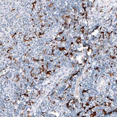 Immunohistochemistry-Paraffin: CD163 Antibody (CL10652) [NBP3-07981]