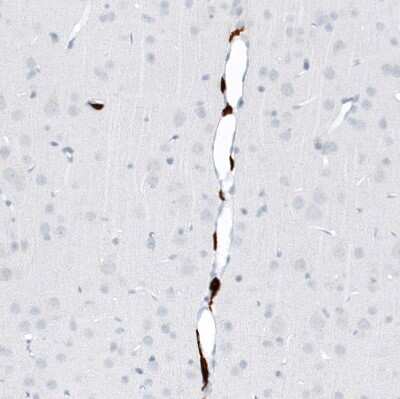 Immunohistochemistry-Paraffin: CD163 Antibody (CL10652) [NBP3-07981]