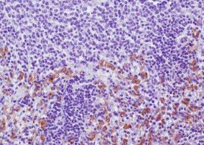 Immunohistochemistry-Paraffin: CD163 Antibody (ED2) - BSA Free [NBP2-39099]