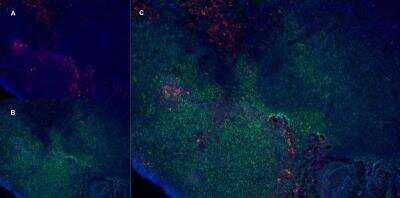 Immunocytochemistry/ Immunofluorescence: CD163 Antibody (ED2) - BSA Free [NBP2-39099]