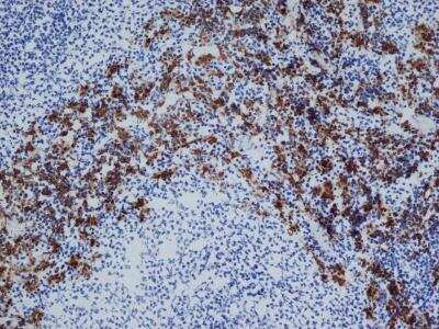 Immunohistochemistry-Frozen: CD163 Antibody (ED2) - BSA Free [NBP2-39099]