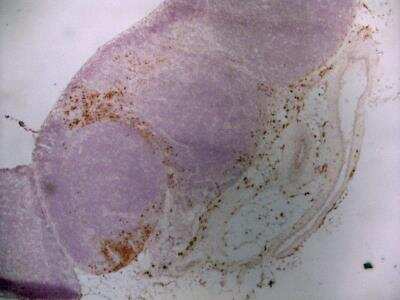 Immunohistochemistry-Frozen: CD163 Antibody (ED2) - BSA Free [NBP2-39099]