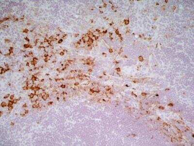 Immunohistochemistry-Frozen: CD163 Antibody (ED2) - BSA Free [NBP2-39099]