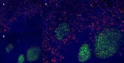 Immunohistochemical Staining of CD163 in Frozen Human Tonsil