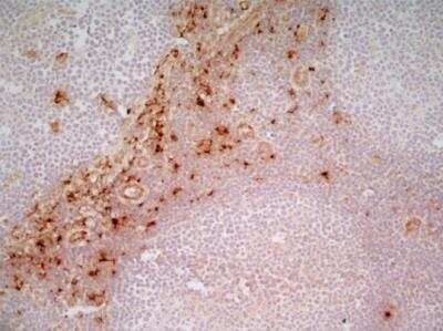 Immunohistochemical Staining of CD163 in Frozen Human Tonsil