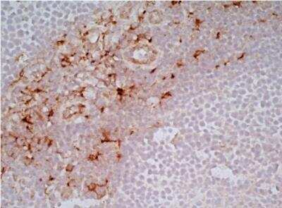 Immunohistochemical Staining of CD163 in Frozen Human Tonsil
