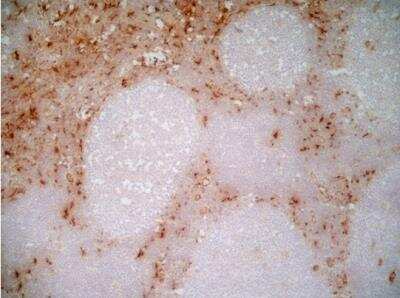 Immunohistochemical Staining of CD163 in Frozen Human Tonsil