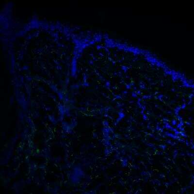 Immunohistochemical Staining of CD163 in Frozen Human Skin