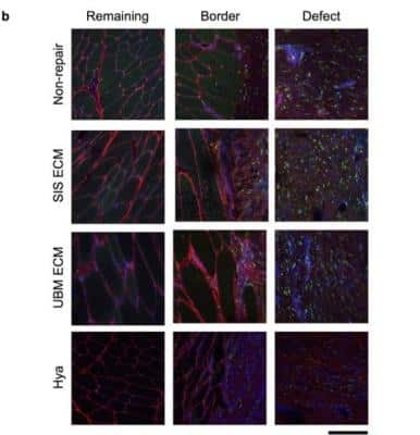Immunohistological Staining of CD163 in Injured Muscle Tissue