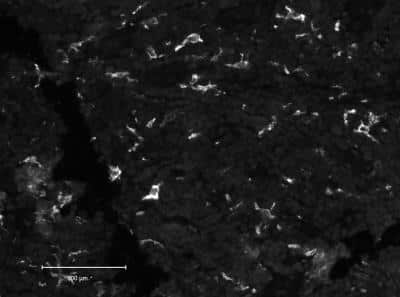 Immunohistochemical Staining of CD163 in Paraffin Embedded Human Tonsil