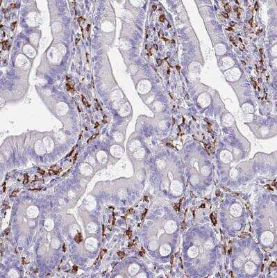 Immunohistochemistry-Paraffin: CD163 Antibody [NBP2-48846]