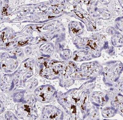 Immunohistochemistry-Paraffin: CD163 Antibody [NBP2-48846]