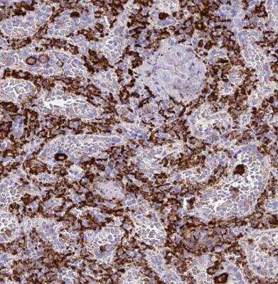 Immunohistochemistry-Paraffin: CD163 Antibody [NBP2-48846]