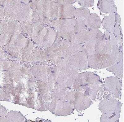 Immunohistochemistry-Paraffin: CD163 Antibody [NBP2-48846]
